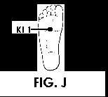 Illustration of Acupuncture points.