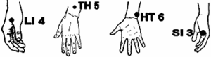 Acupuncture points on the hand and wrist for treating chronic pain.