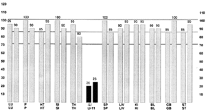 EMI graph of case history #1.