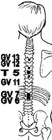 Acupuncture points along the spine for treating chronic pain.