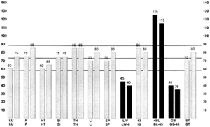 EMI graph of case history#2.