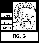 Illustration of Acupuncture points.