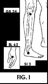 Illustration of Acupuncture points.