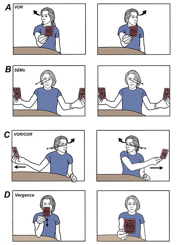 Gaze stabilization exercises