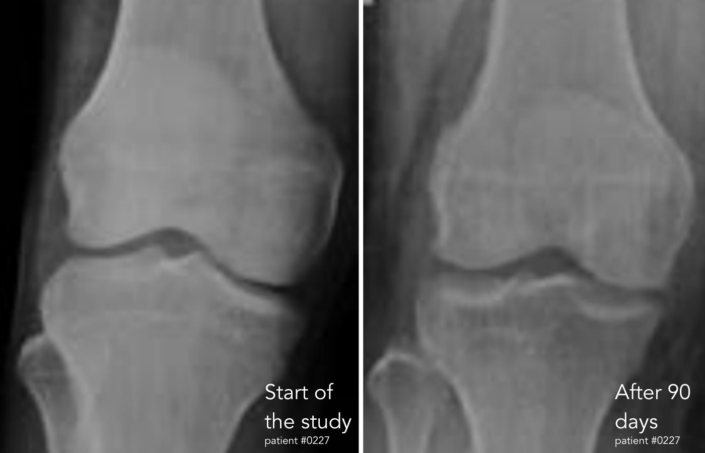 Regenerative Pain Relief