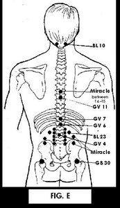 The Lumbar Spine: How to Achieve Outrageous Clinical Results