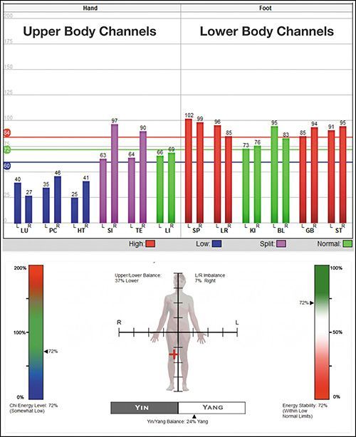 Breech Baby A Scientific Approach