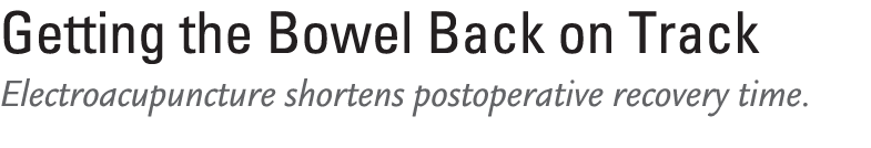 Getting the Bowel Back on Track Electroacupuncture shortens postoperative recovery time. 