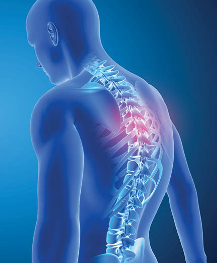 3D render of a Medical background showing good and poor posture with spine highlighted