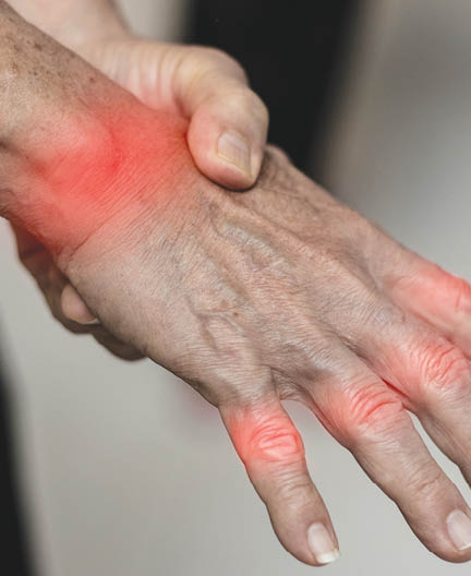 Overuse hand problems. Woman’s hand with red spot o fingers as suffer from Carpal tunnel syndrome. The symptoms of tingling, numbness, weakness, or pain of the fingers and wrist. 