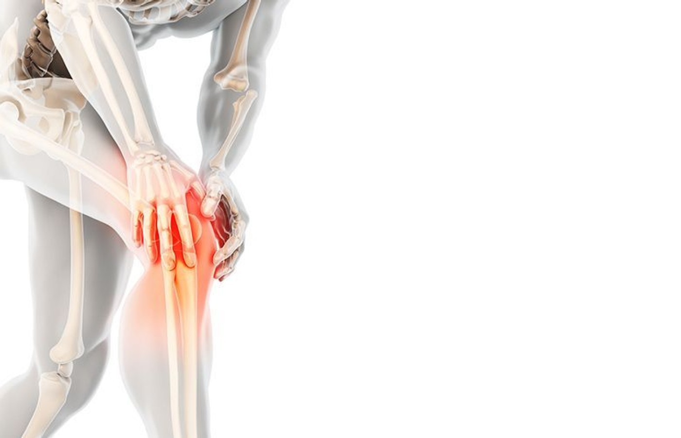 knee osteoarthritis