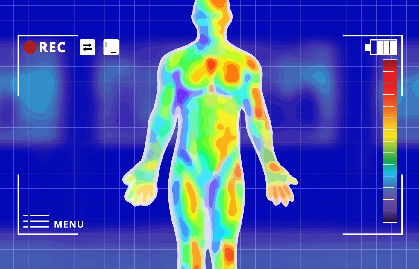 Musculoskeletal Thermography:  The Clinical Benefits