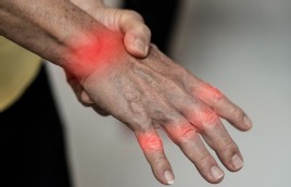 Arthritis: Osteo vs. Rheumatoid