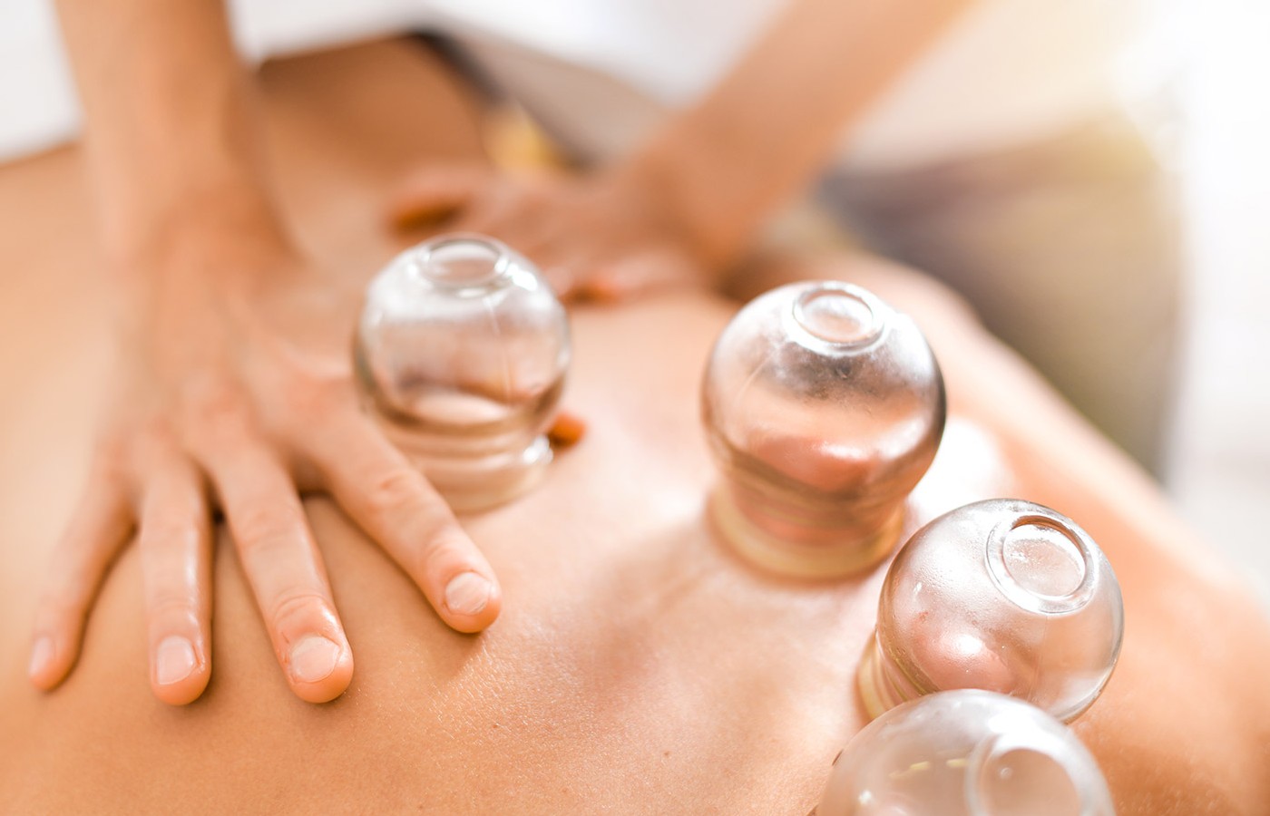 Vesicle Formation After Cupping: Clinical Insights & Management Considerations