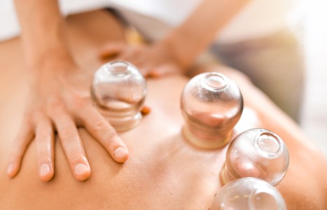 Vesicle Formation After Cupping: Clinical Insights & Management Considerations