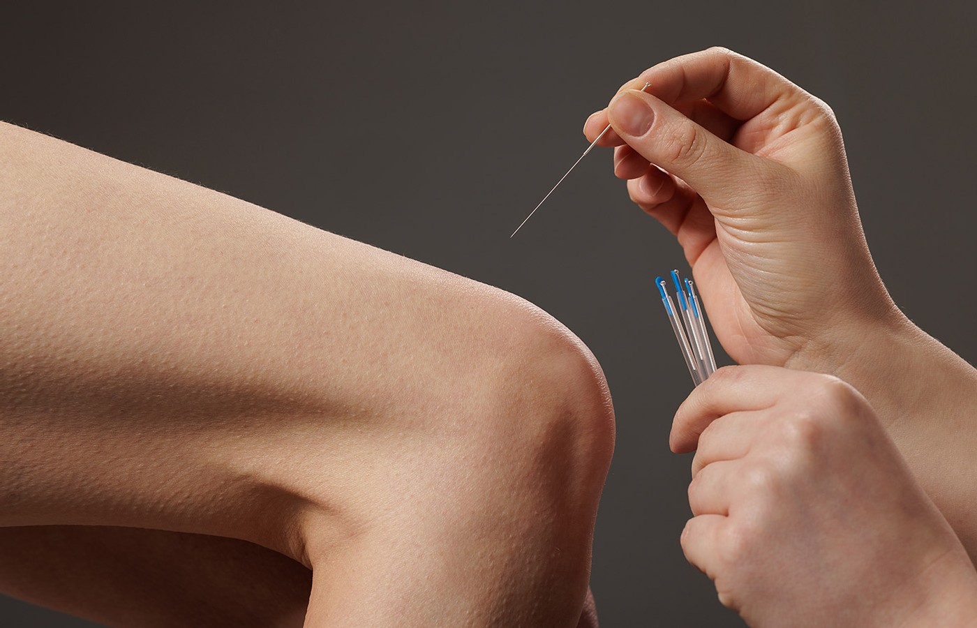 Reclaiming Our Expertise: Why Acupuncturists Must Lead in Dry Needling
