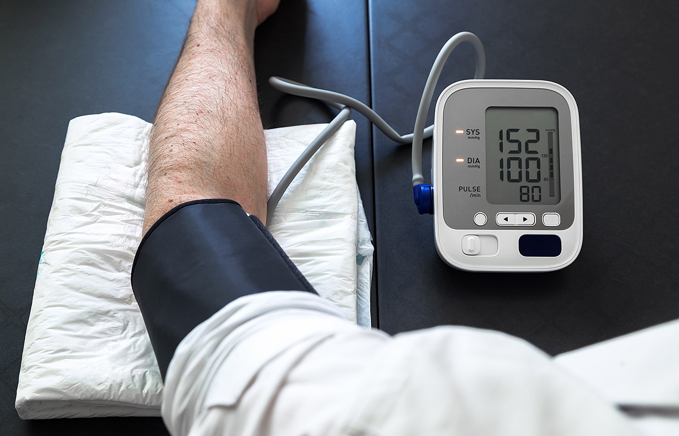 Looking Beyond the Numbers: Clinical Clues in Patients With Hypertension