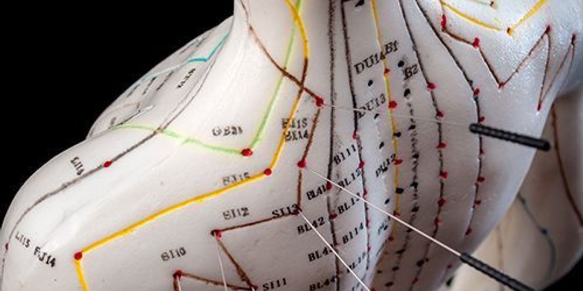 Acupat Pattern Releasing PTSD With the Vibrational Acu-Point Method | Acupuncture Today