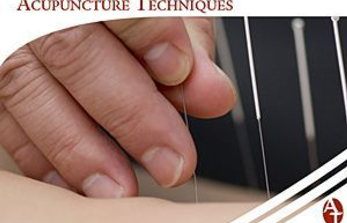 Acupuncture Technique
