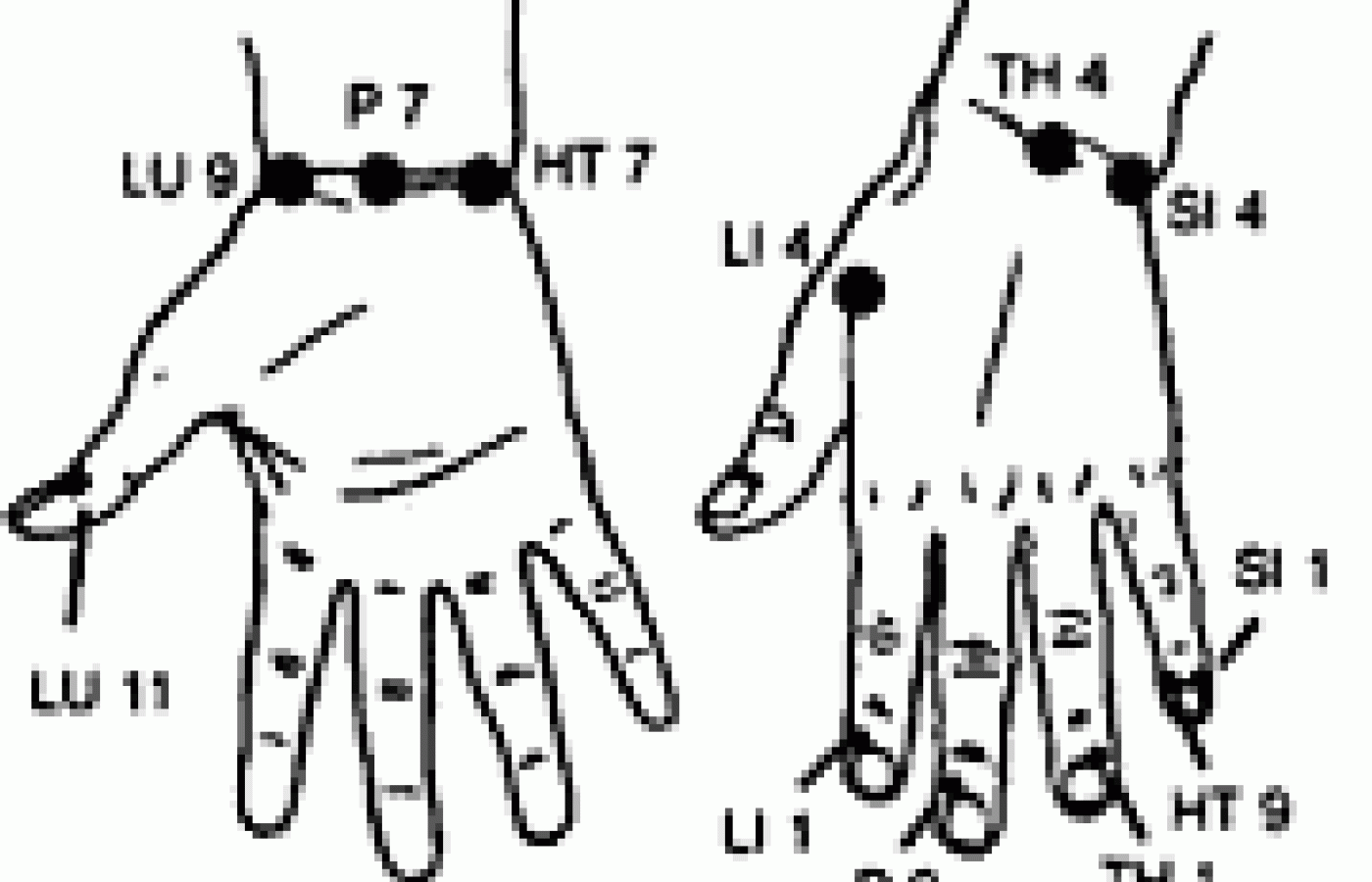 Diagram of showing Source and tsing points of the wrists and ankles.