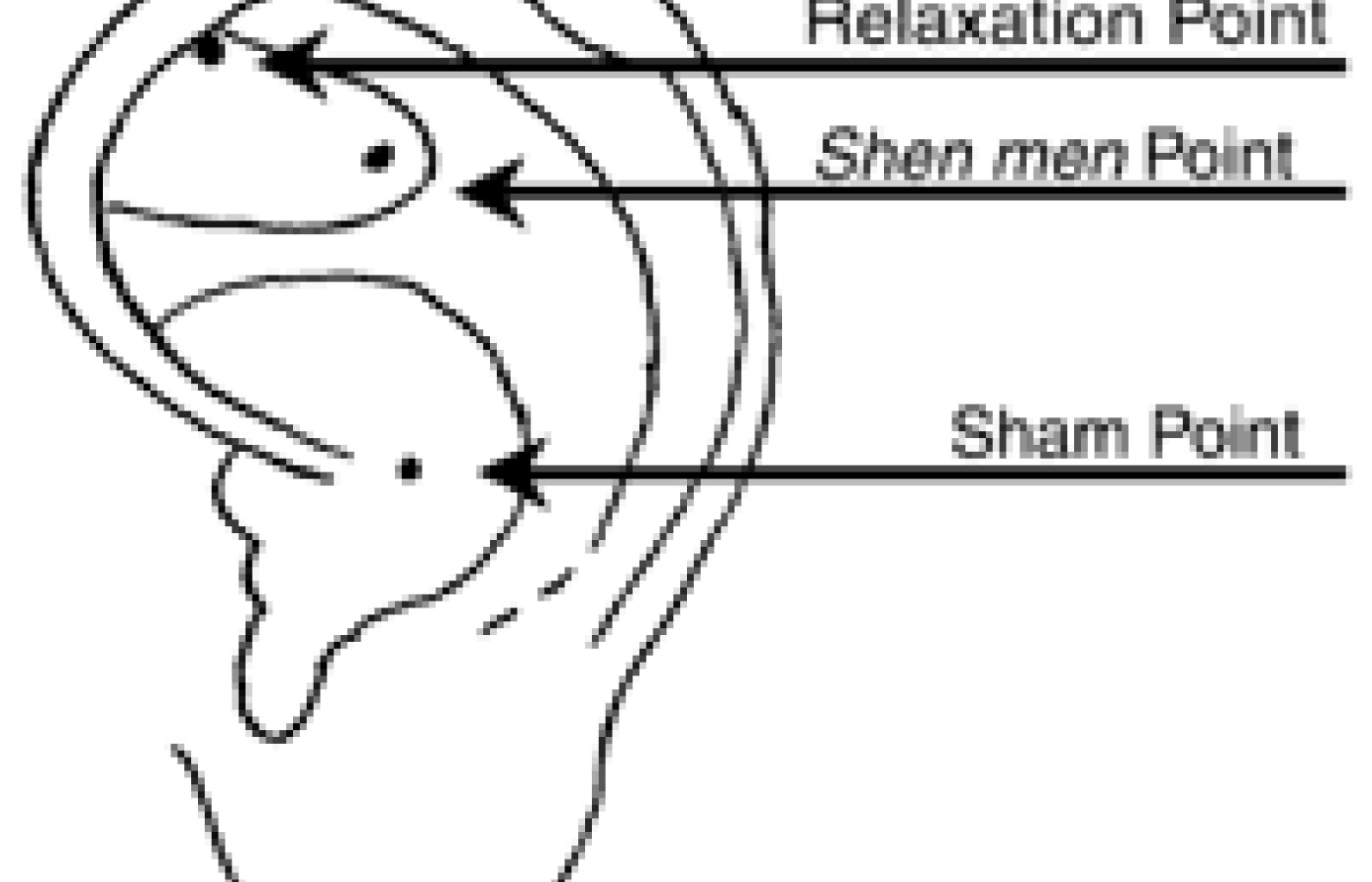 Anatomical locations of the shen men, relaxation and sham acupoints.