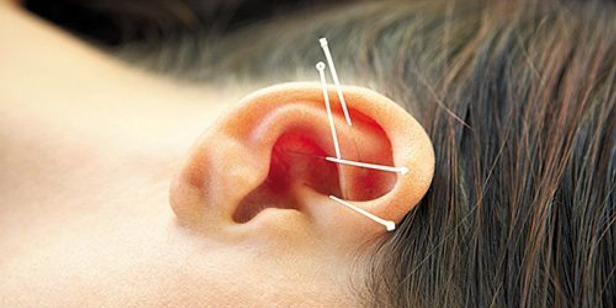 German Auricular Acupuncture Effective For Your Patients Acupuncture