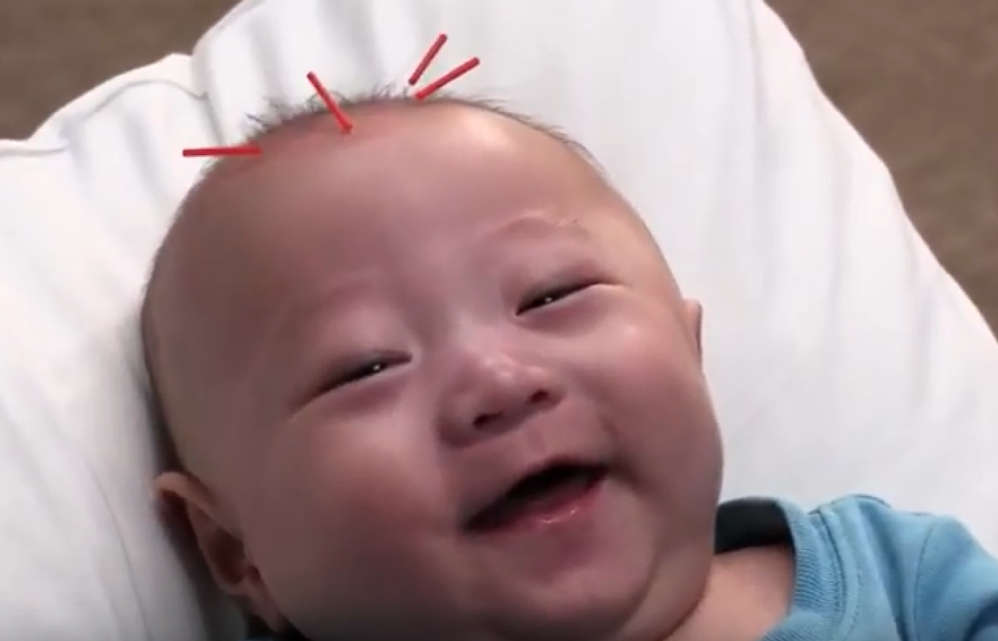 baby with needles