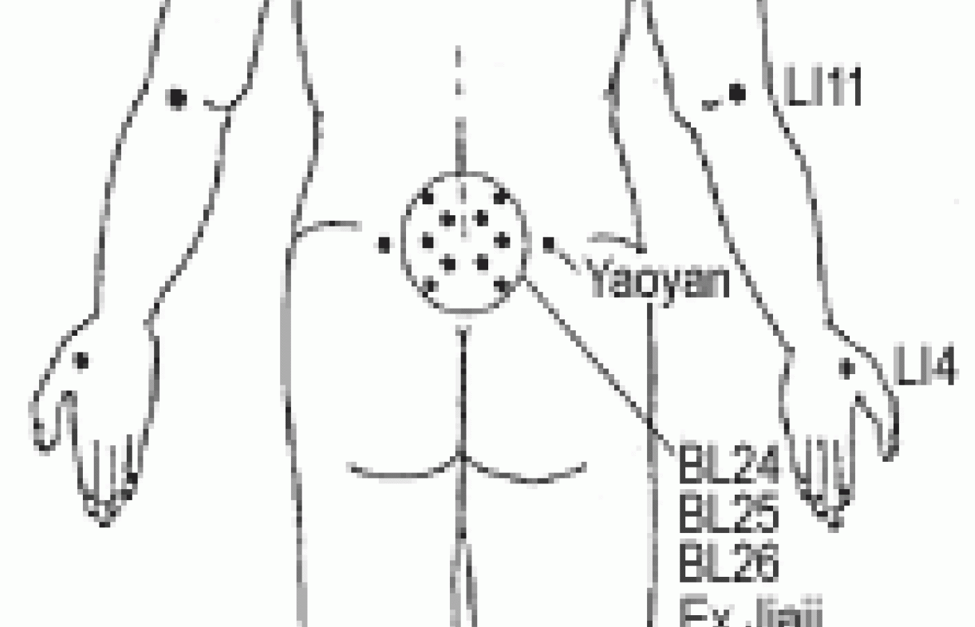 Illustration of acupuncture points.