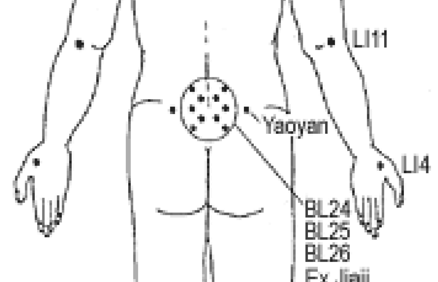 Illustration of acupuncture points.