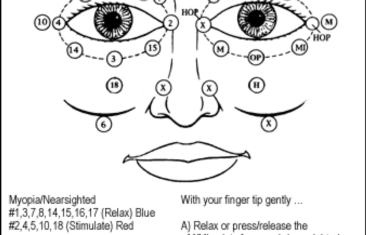 Diagram showing acupressure points surrounding each eye and cheek area.