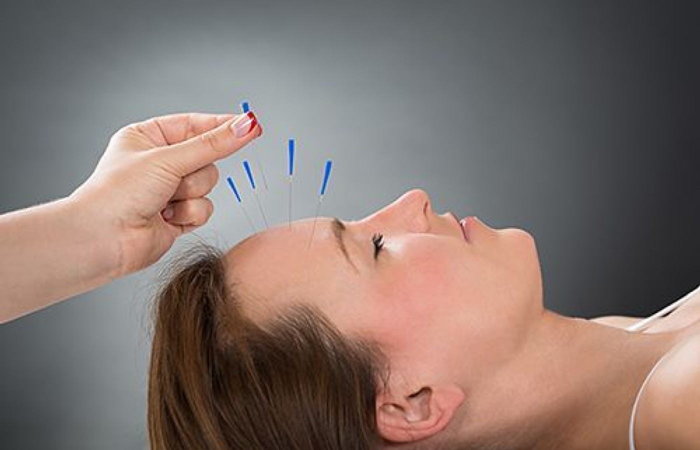 Cosmetic Acupuncture