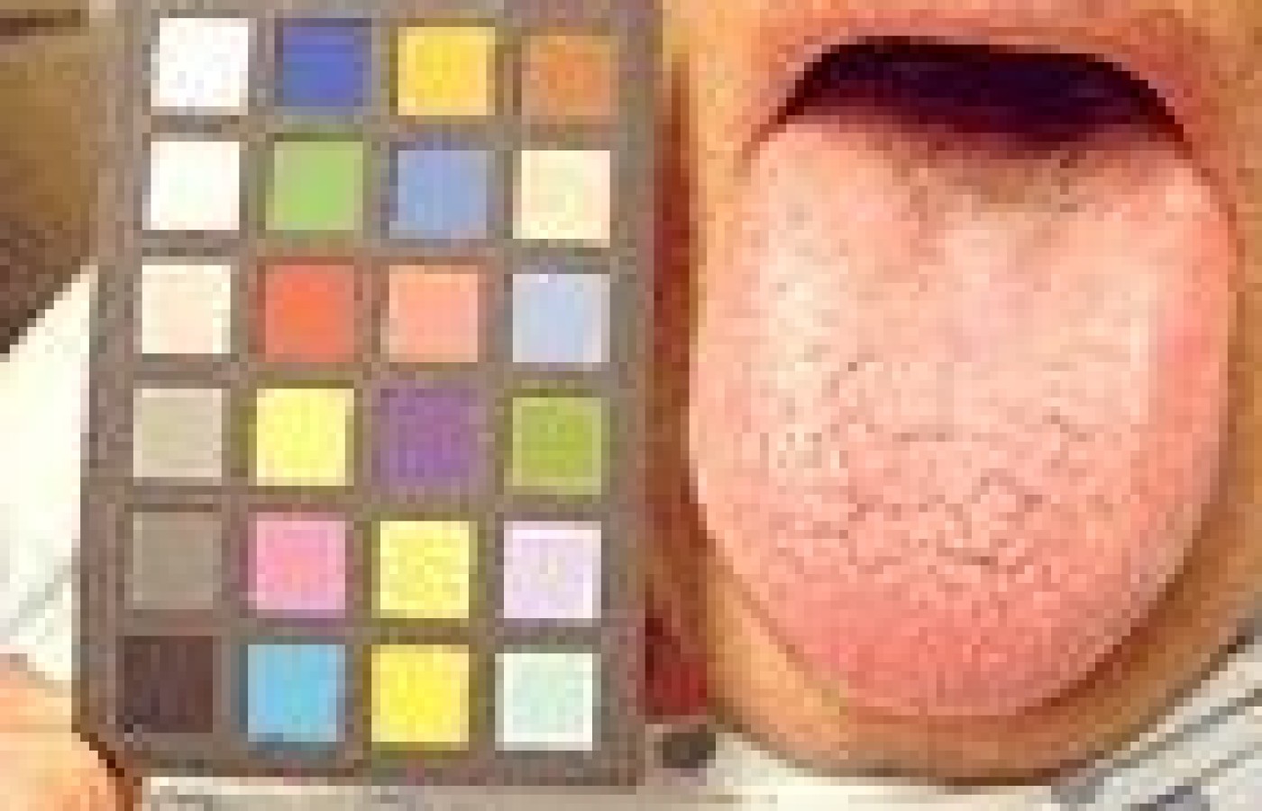 Man's tongue and calibration chart.