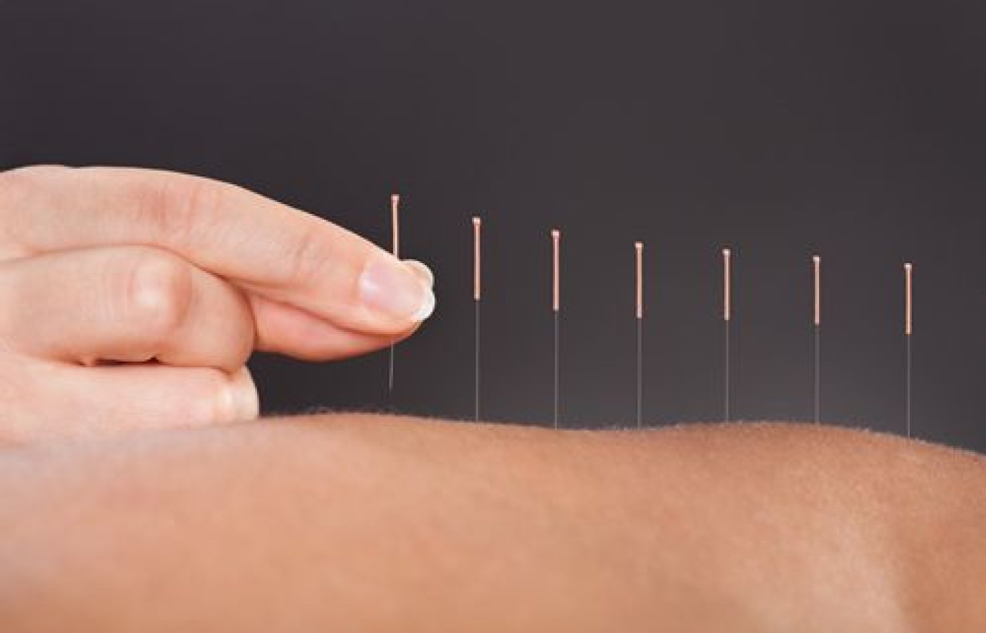 Eczema & Acupuncture: A Sound Solution (Part 1)