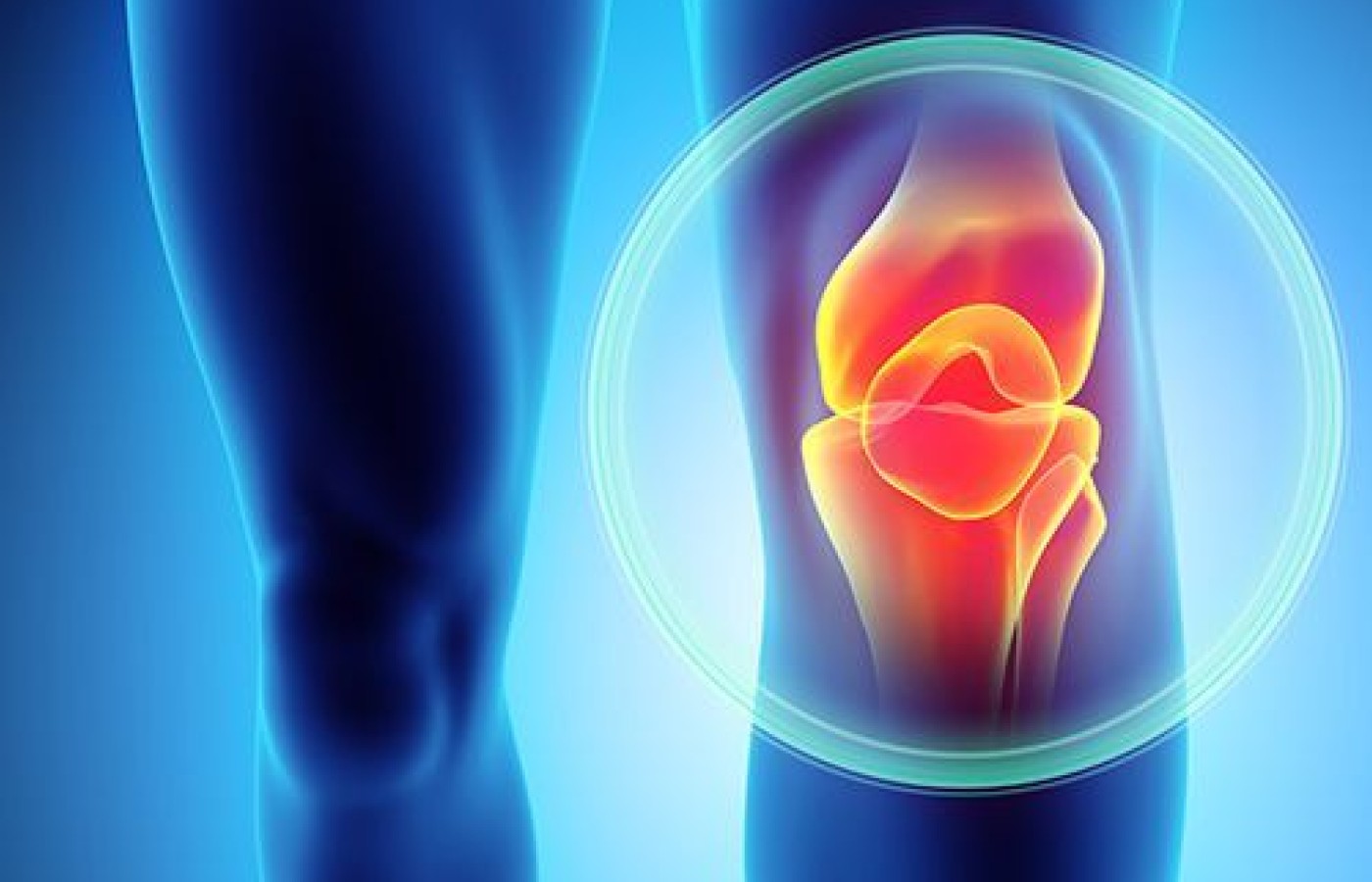 Knee Therapy: Art or Science?