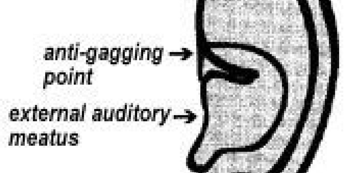 Acupuncture May Cure Gag Reflex in Dental Patients Acupuncture Today