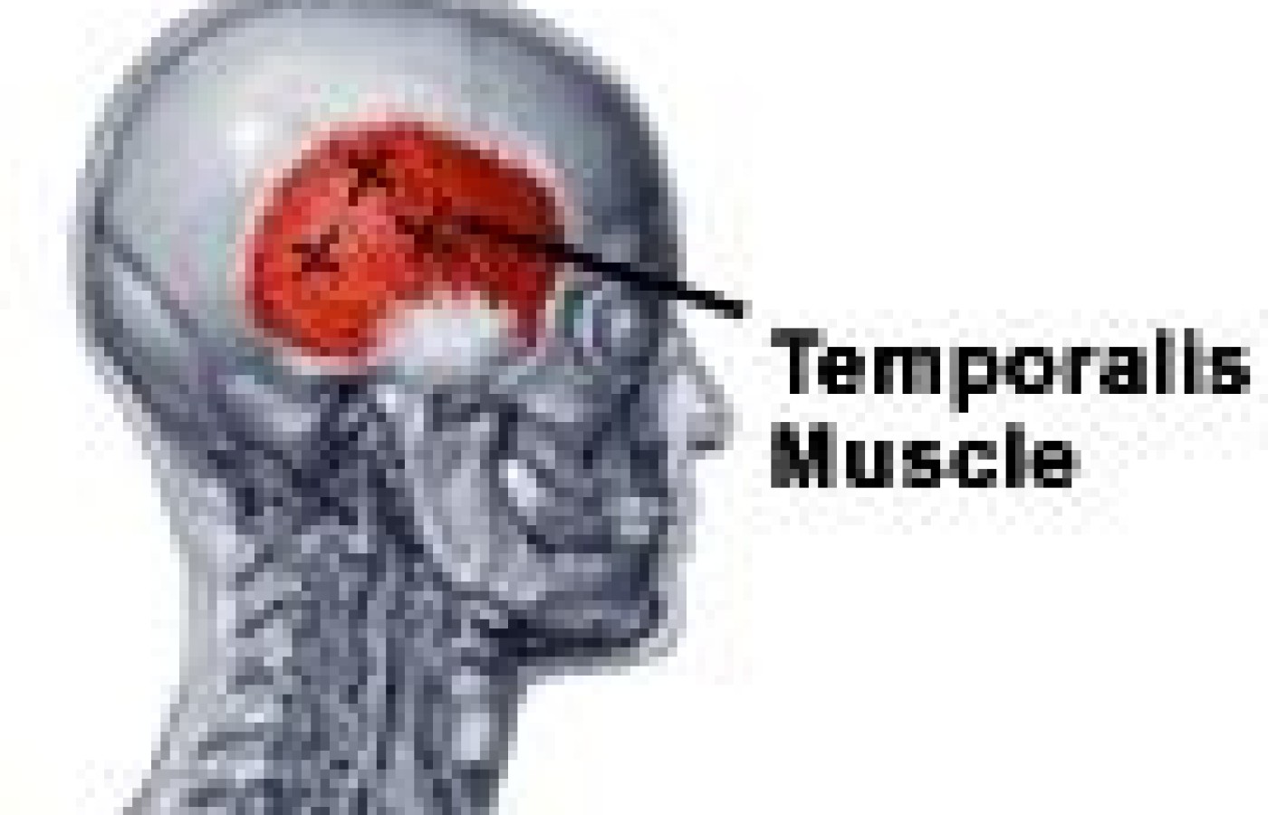 The temporomandibular joint and temporalis muscle.