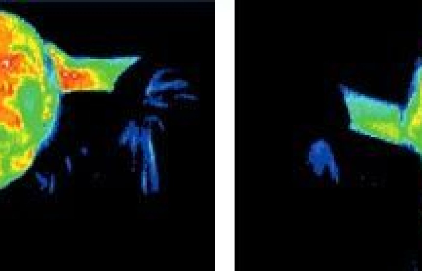 Infrared images of head.