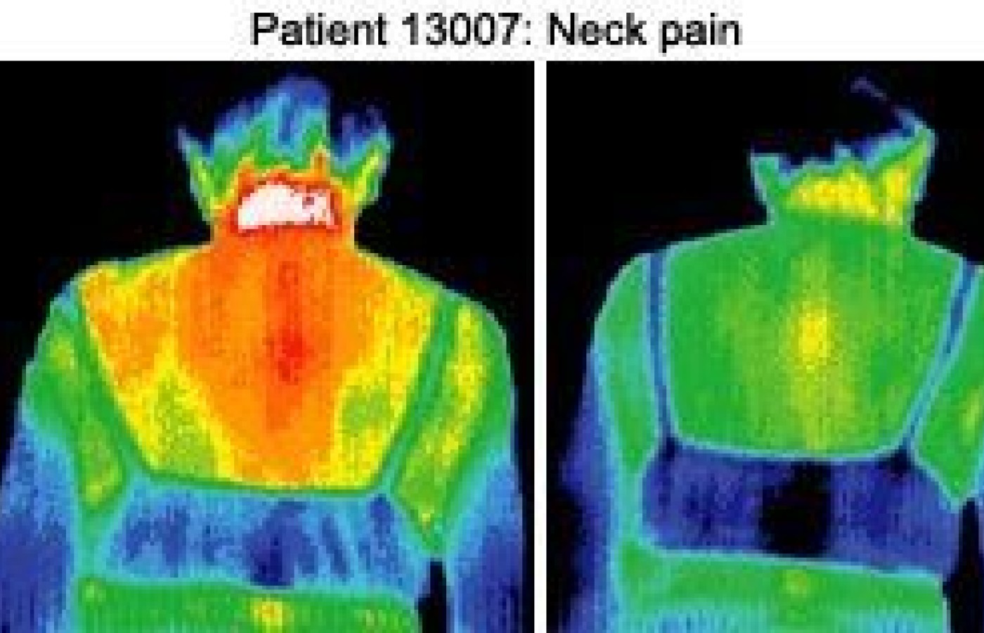 Infrared images of patient.