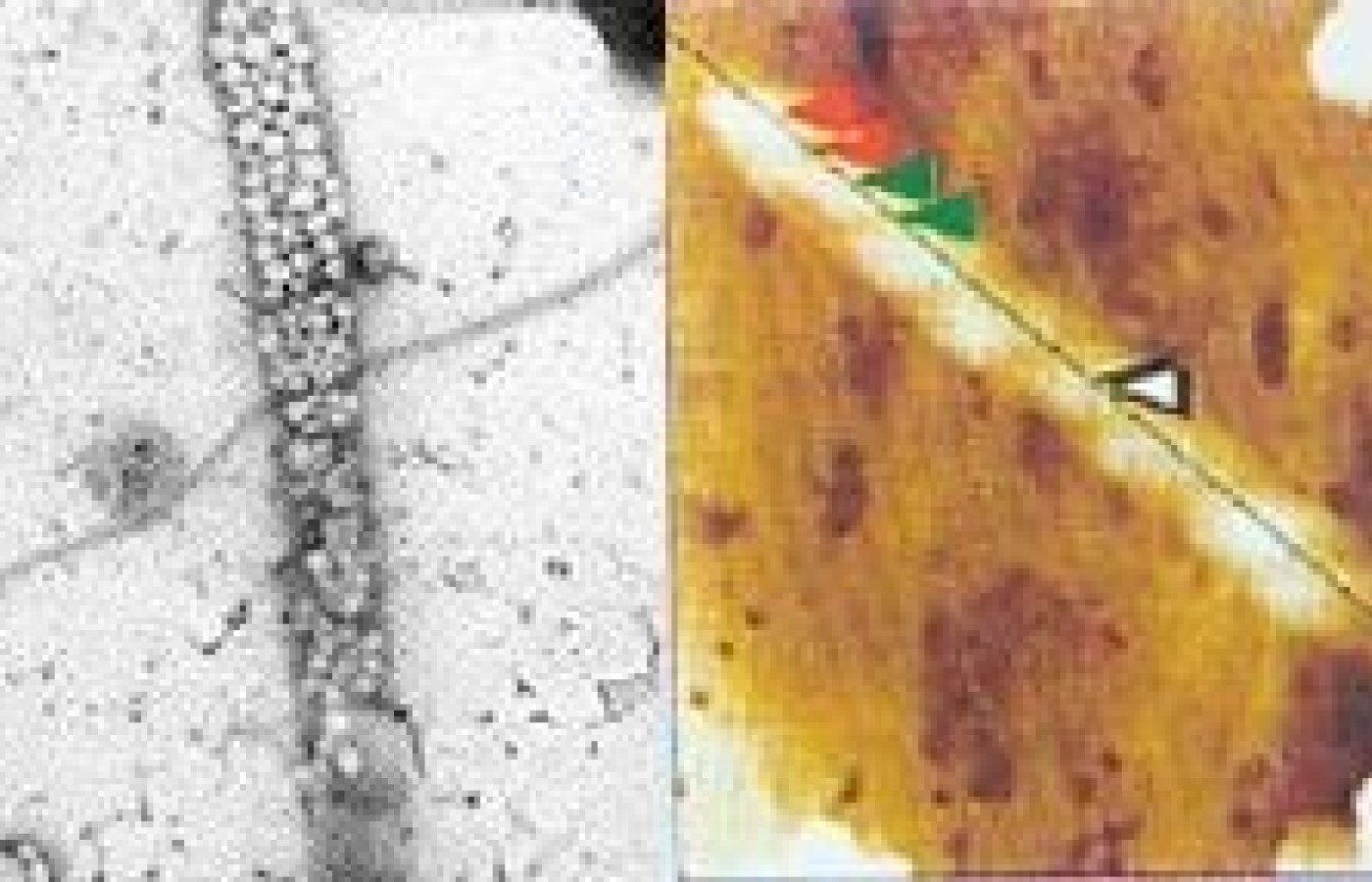 Transmission electron microspope picture of chain of water clusters.