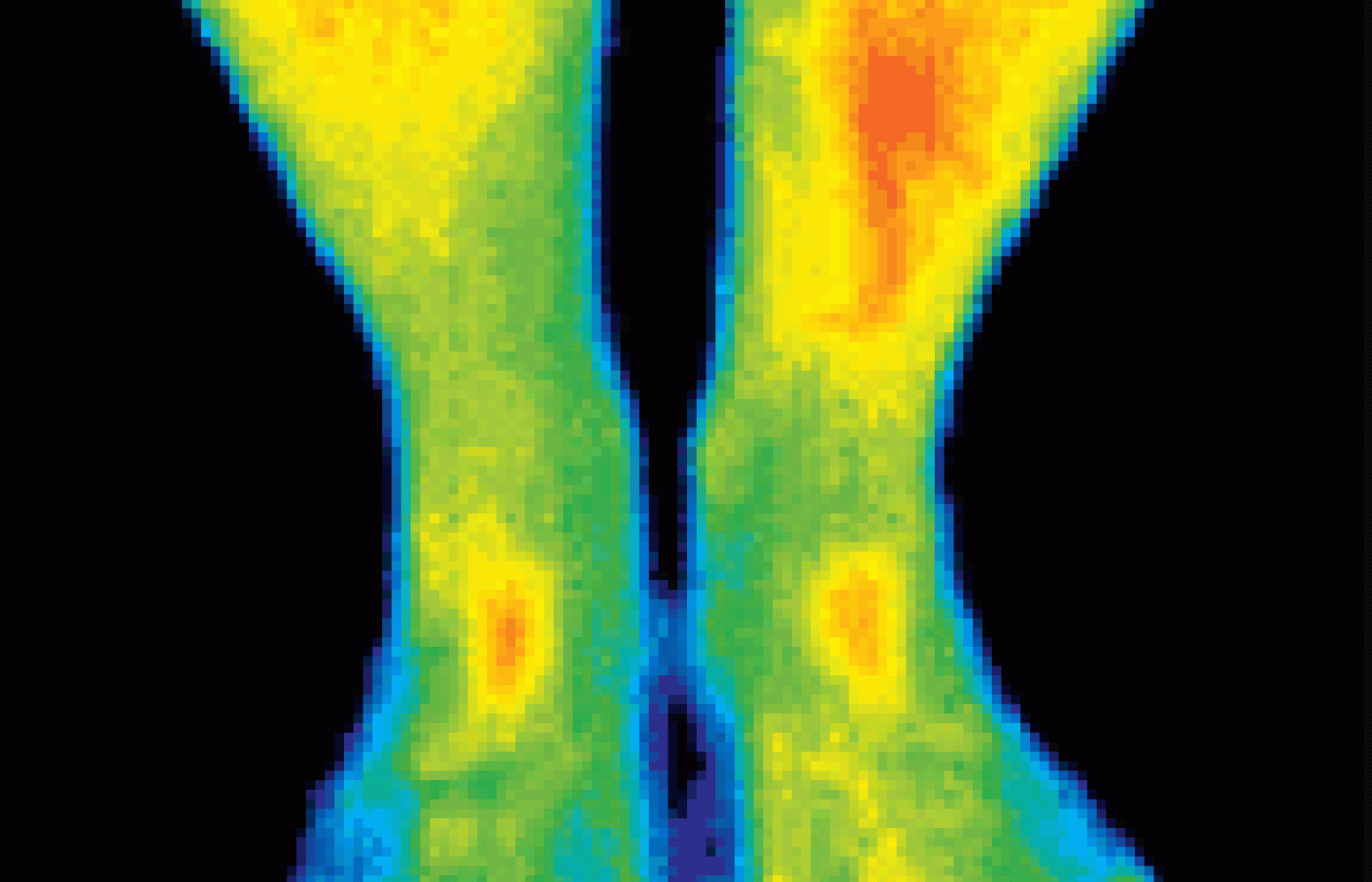 Infared image of lower legs and feet.