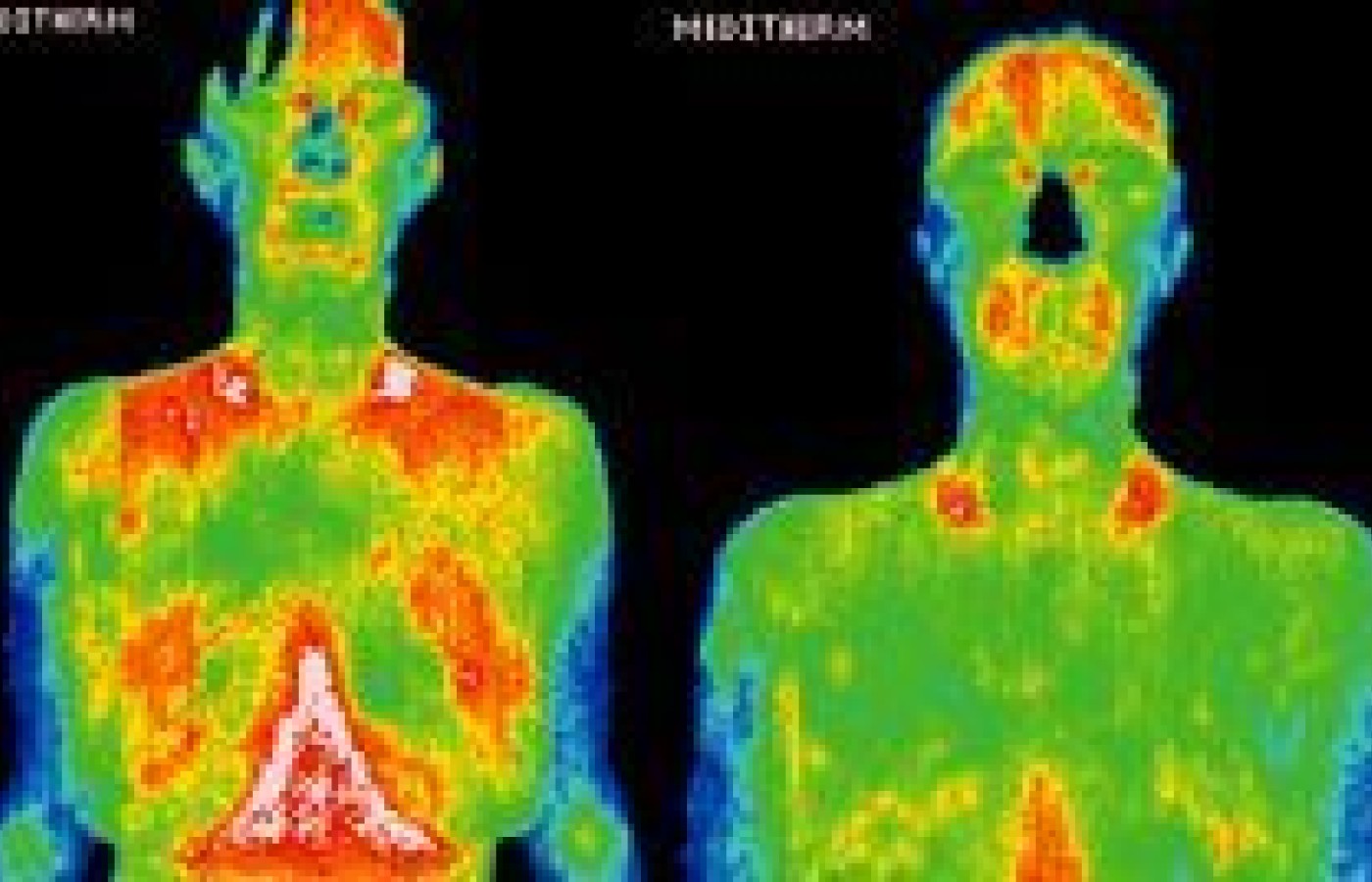 Infrared images showing body surface temperature distribution.