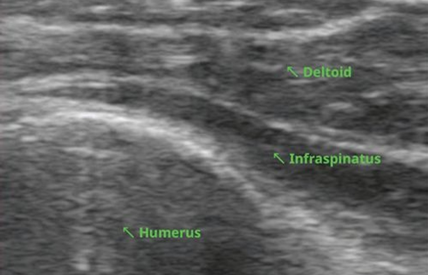 musculoskeletal ultrasound