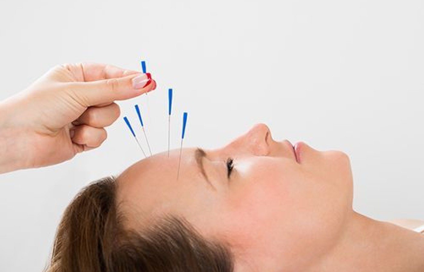 The FDA Recommends Acupuncture: Comments From Key AOM Stakeholders