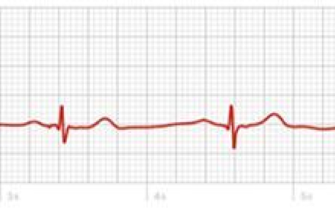 Slow (54 beats per minute)