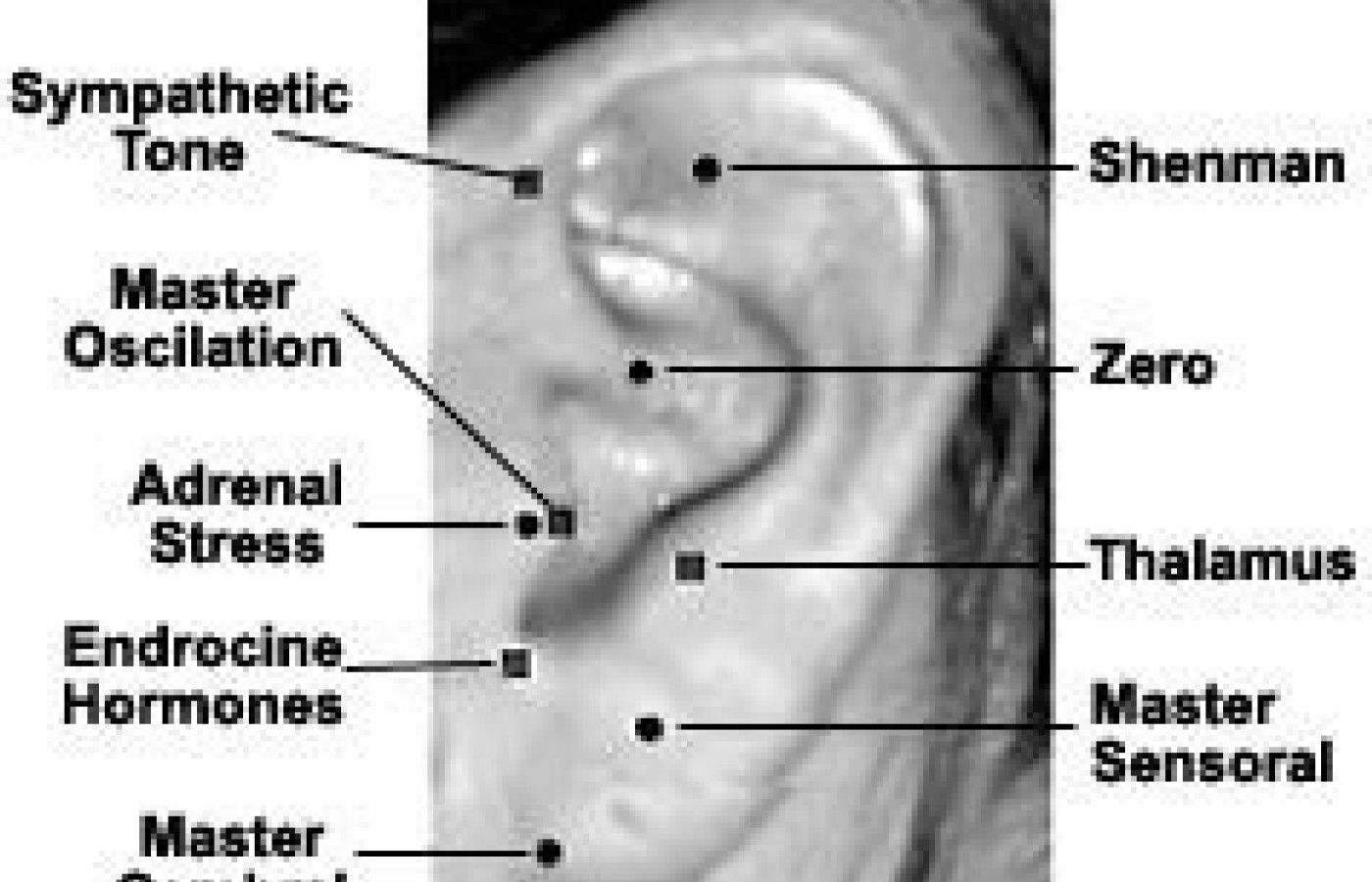 Auricular master points.