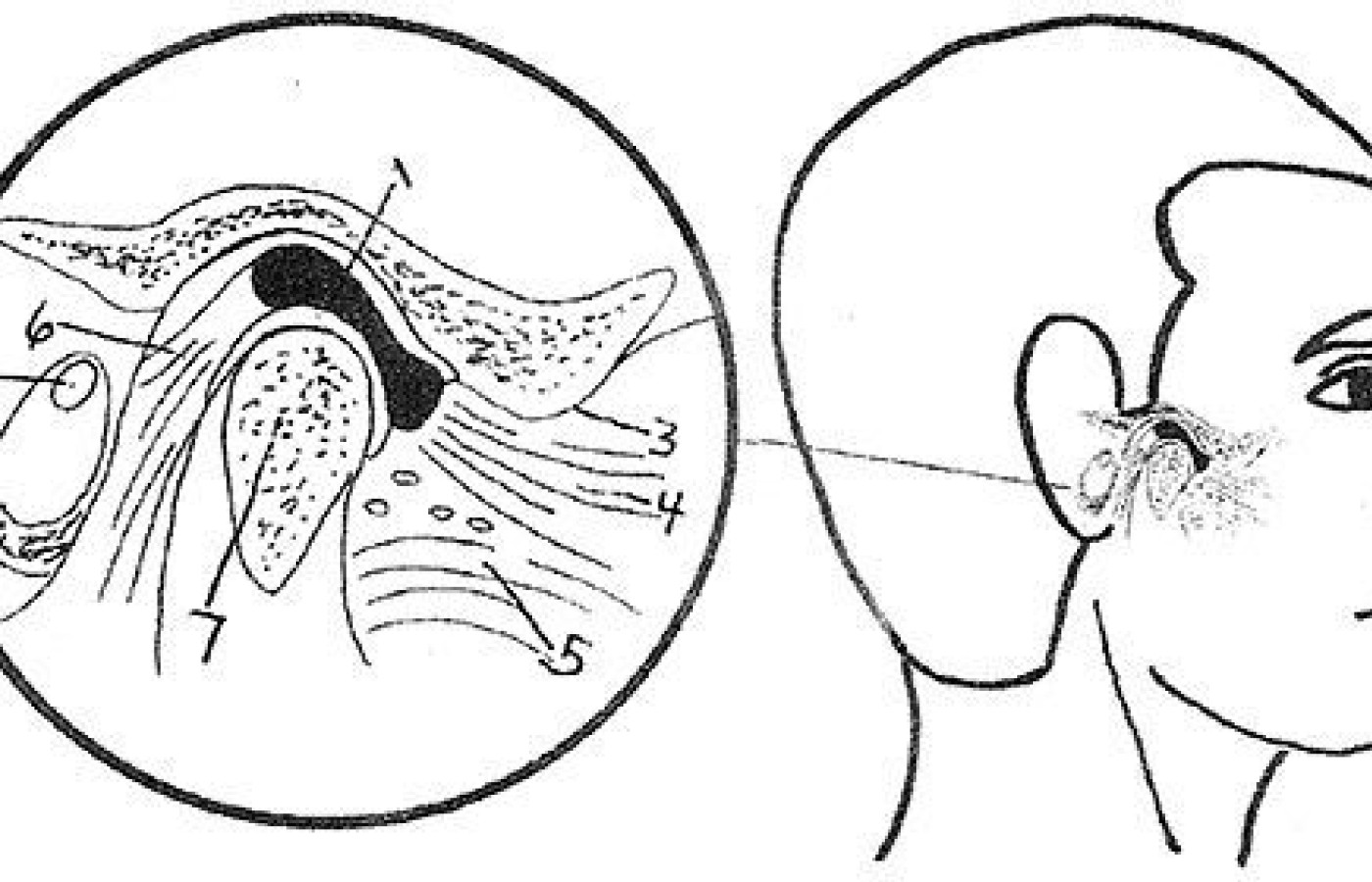 Temporomandibular Joint