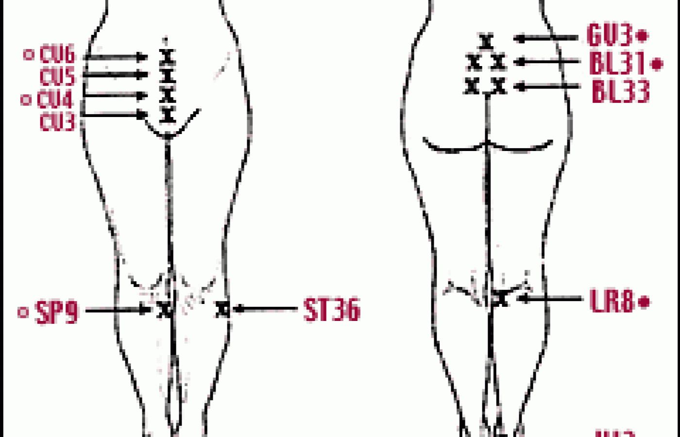 Acupoints used for the treatment of vulvar vestibulitis.